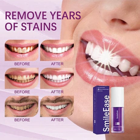 Teeth Whitening Serum