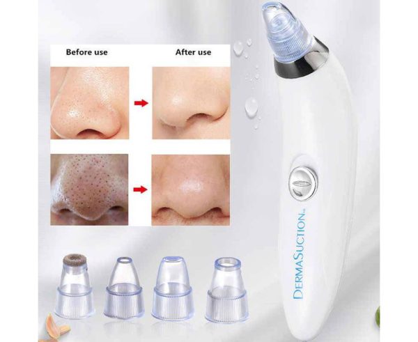 Blackhead Remover | Vacuum Suction