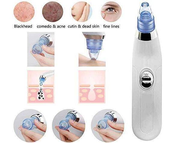 Blackhead Remover | Vacuum Suction
